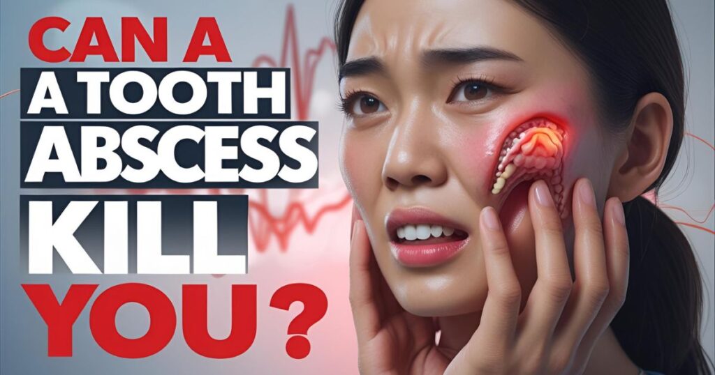 Can a Tooth Abscess Kill You